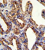 TACSTD2 antibody, Internal