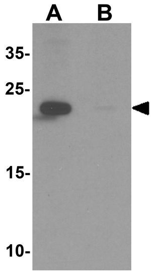 ZFYVE21 antibody
