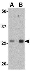 TREX1 antibody