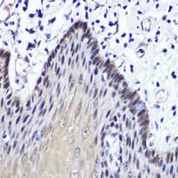 Thymidine Kinase 1 antibody