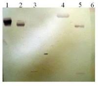 Plasminogen antibody [11B5-B2]