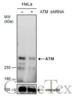 ATM antibody