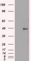 FOXA1 antibody [3A8]