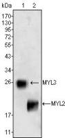 Myosin Light Chain 2 (MLC-2v) antibody [7C9]