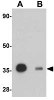 REEP3 antibody