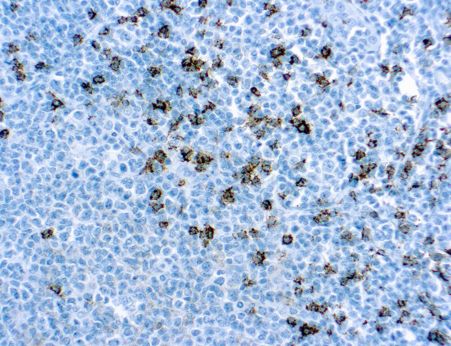 CD8 antibody [SP16]