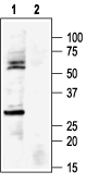 Kir6.1 antibody