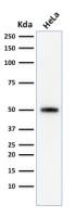 p53 antibody [SPM590]