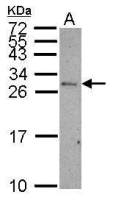 CD99 antibody
