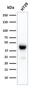 Cytokeratin 20 antibody [KRT20/3129R]