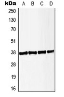 LAT (phospho Tyr191) antibody