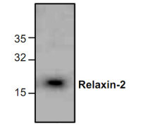 Relaxin 2 antibody