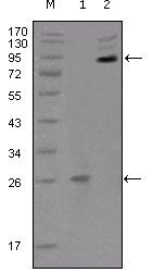 EphB2 antibody [2D12C6]