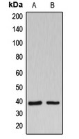 B3GALT1 antibody