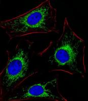 Glutaminase antibody, C-term