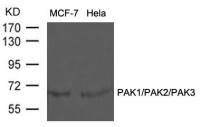 PAK1/PAK2/PAK3 antibody