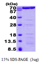 Human Annexin VI protein, His tag