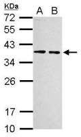 RPLP0 antibody