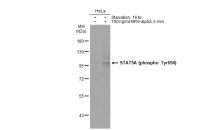 STAT5A (phospho Tyr694) antibody [GT1208]