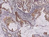 TIE1 antibody [8D2D2]