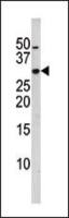 p27 Kip1 (phospho Ser10) antibody