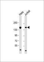 EPRS antibody, N-term