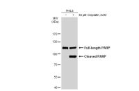 PARP antibody [GT1176]