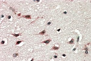 DYX1C1 (Isoform a) antibody, C-term