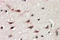 DYX1C1 (Isoform a) antibody, C-term