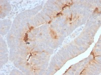 SAA1 + SAA2 antibody [SAA/2868R]
