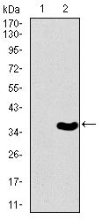 Brachyury antibody [1H9A2]