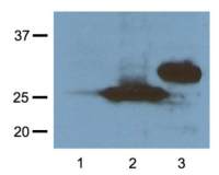 RFP antibody [RF5R]