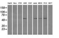 Fumarate hydratase antibody [9G4]