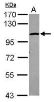 CPSF2 antibody [N1N3]