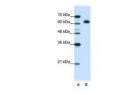 DIS3L2 antibody, N-term