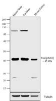 Tau (phospho Ser262) antibody