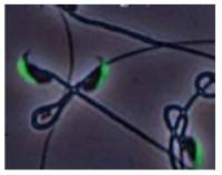 IZUMO1 antibody [#125]