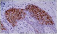 Cytokeratin 10 antibody [VIK-10]