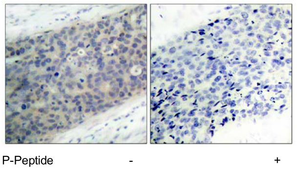 LIM kinase 2 (phospho Thr505) antibody
