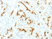 CFTR antibody [CFTR/1775R]