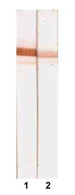 Albumin antibody [6B11]