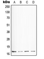 Somatostatin antibody