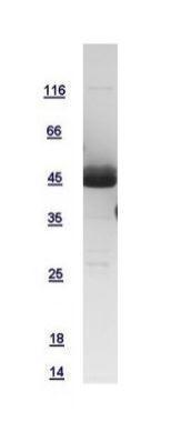 Human CCR1 protein, GST tag