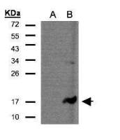 CD3 zeta antibody [C1C3]