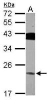 VPS29 antibody