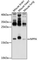 ANP antibody