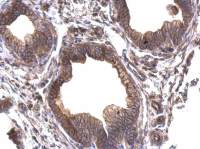 Periplakin antibody [N1N2], N-term