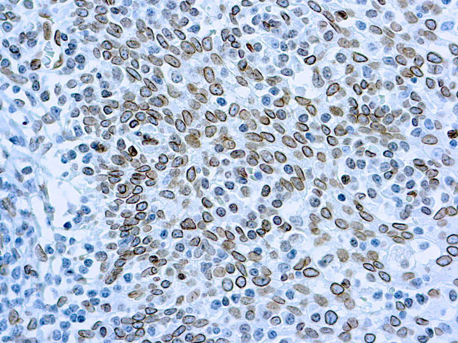 CDC25A antibody [DCS-120 + DCS-121]