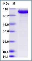 Human Topoisomerase I protein, His tag
