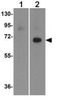 Swine Influenza A virus H1N1 HA (Hemagglutinin) antibody